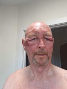 Ged Burke Pints Later